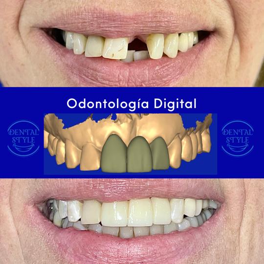 Odontología digital